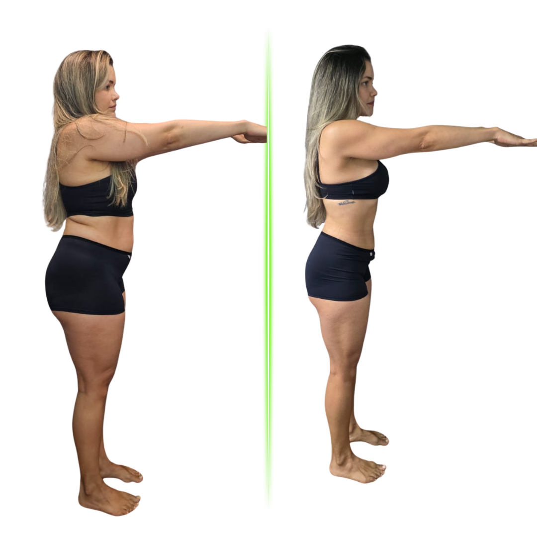 Transformação de Fernanda, 31